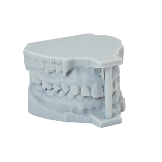 Dental Restoration Model