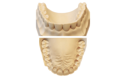 Resina modelo de ortodoncia dental